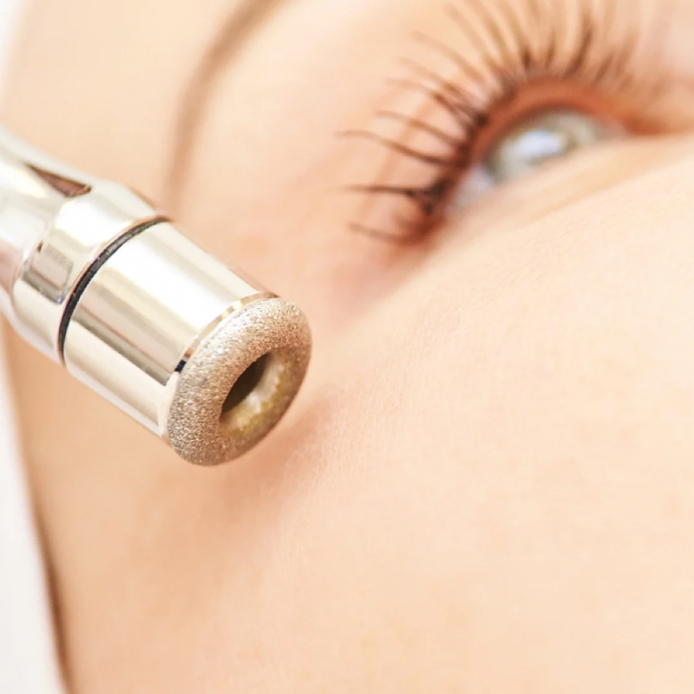 Microdermabrasion Enhancement at The Facial Apothecary in Metuchen, NJ