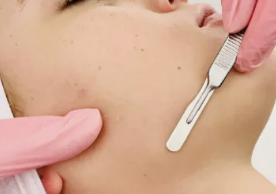 Dermaplane Facial