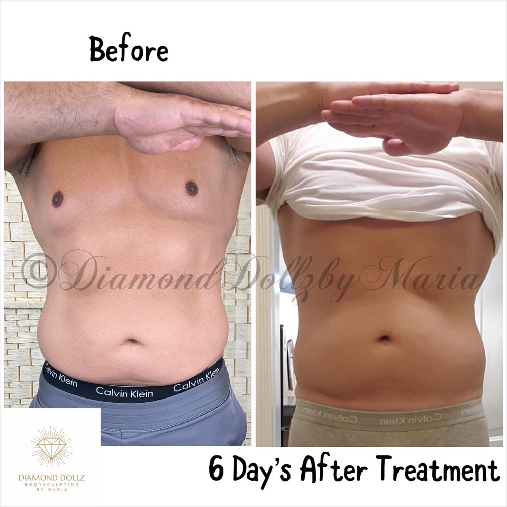(For Men) Tighten & Tone Stomach