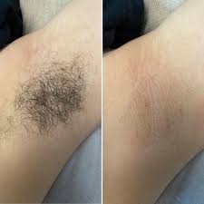 Underarm Wax