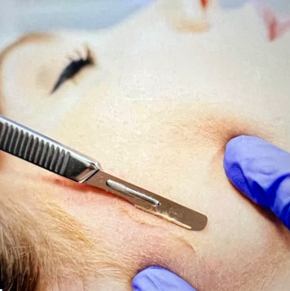 Dermaplaining Facial