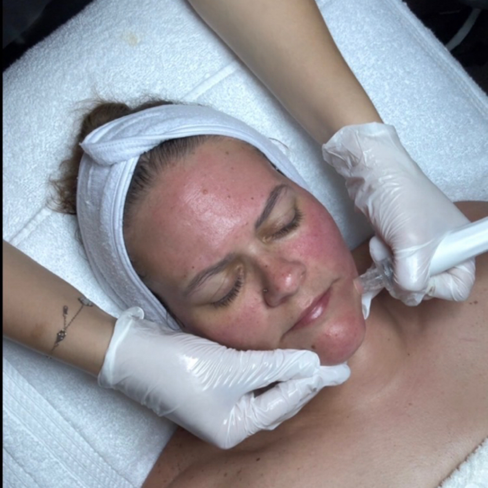 Hydrofacial (Room #1) at Competitive Edge Massage and Wellness in Auburndale, FL