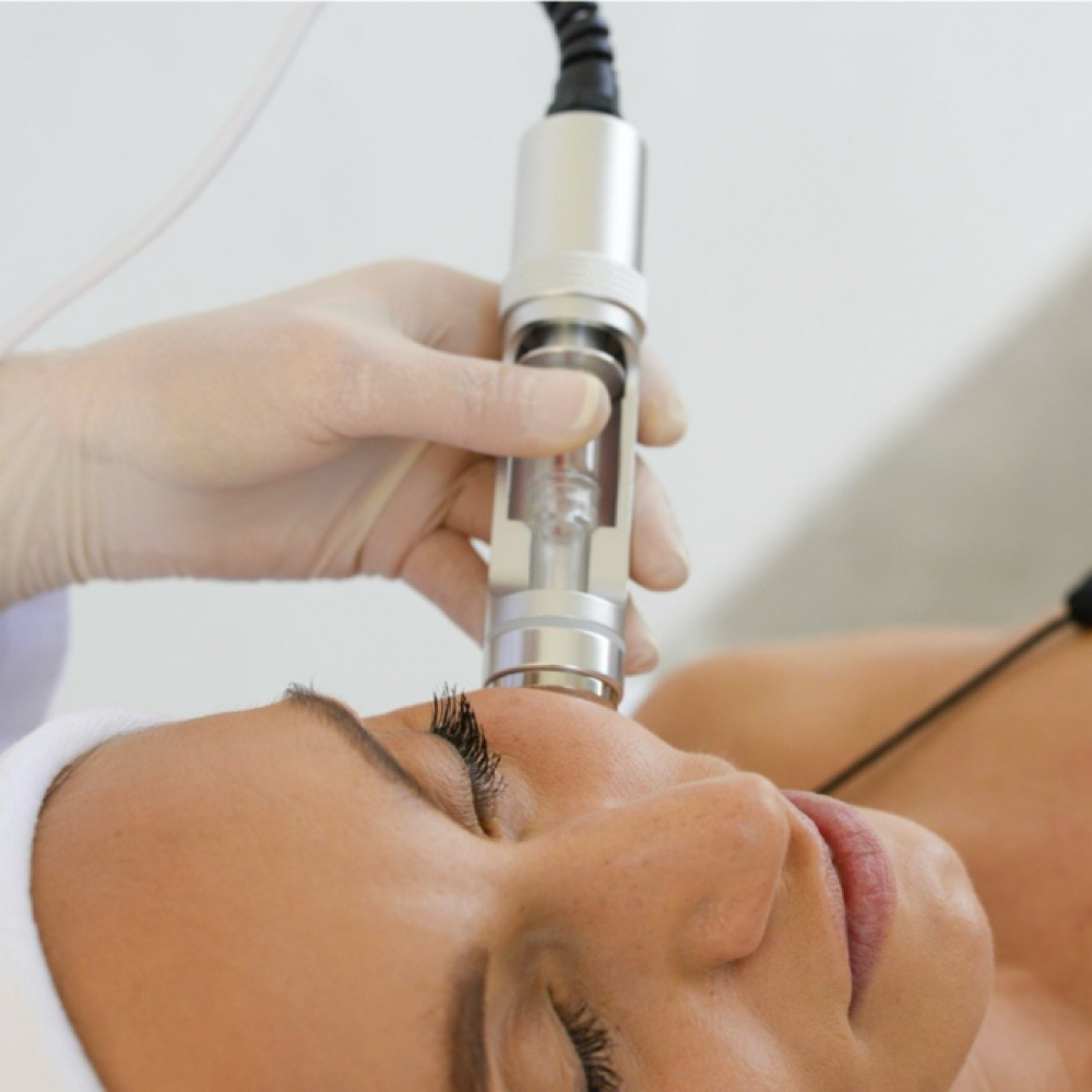 Mesotherapy Face Lift Up Add On at Juniper Room Esthetics in Cleveland, OH