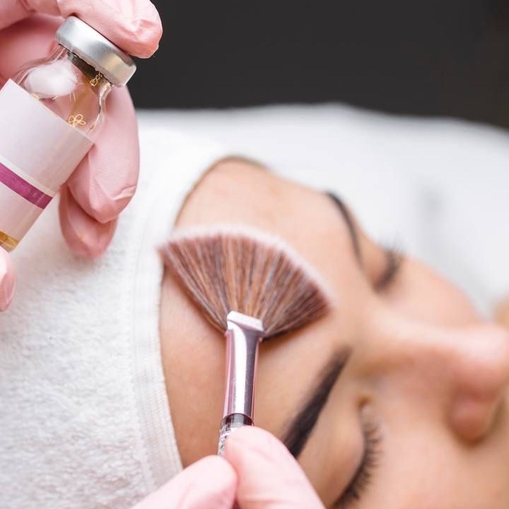 ACNE PEEL at Remake Beauty Studio San Juan in San Juan, TX