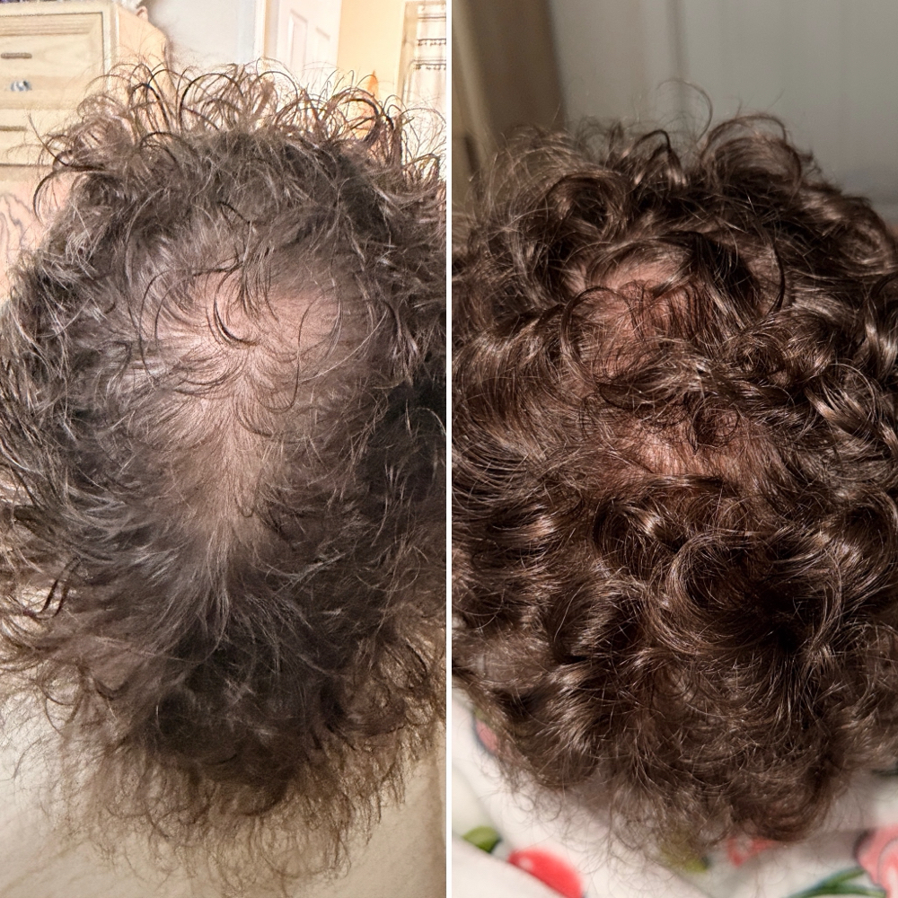 Hair Revitalization at Skin Theory Collective in Port Richey, FL