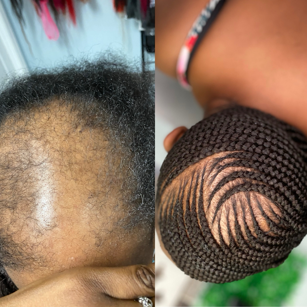 Austin Texas Hairloss Braid at Tobs braiding salon llc in Houston, TX