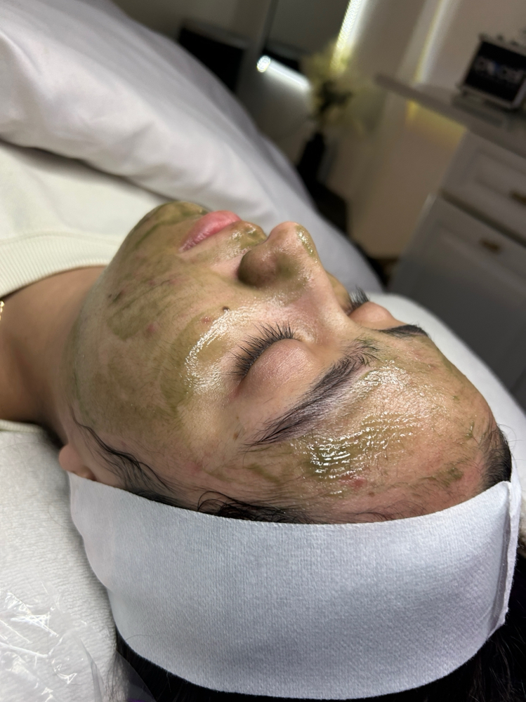 Korean Facial - Chemical Peel