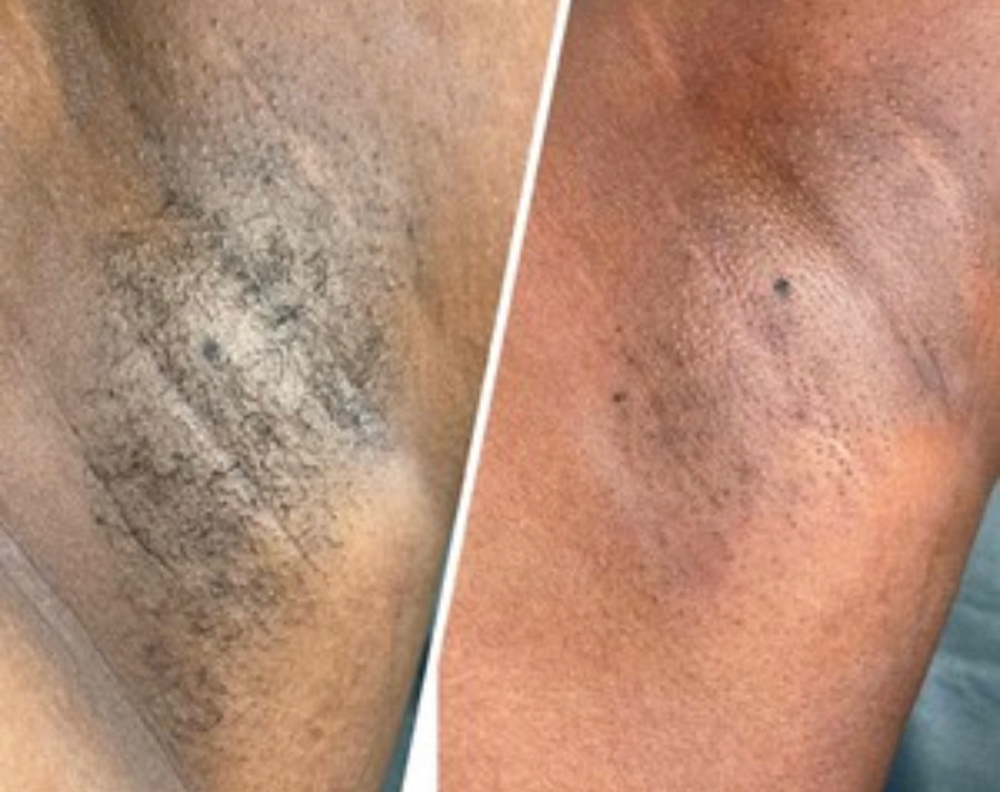 Under Arm Wax