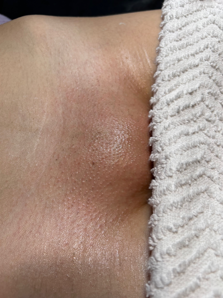 Brazilian Wax