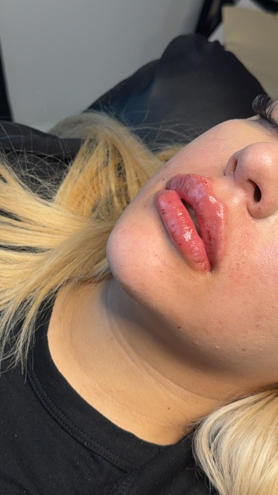 Russian Lip Filler 2ML