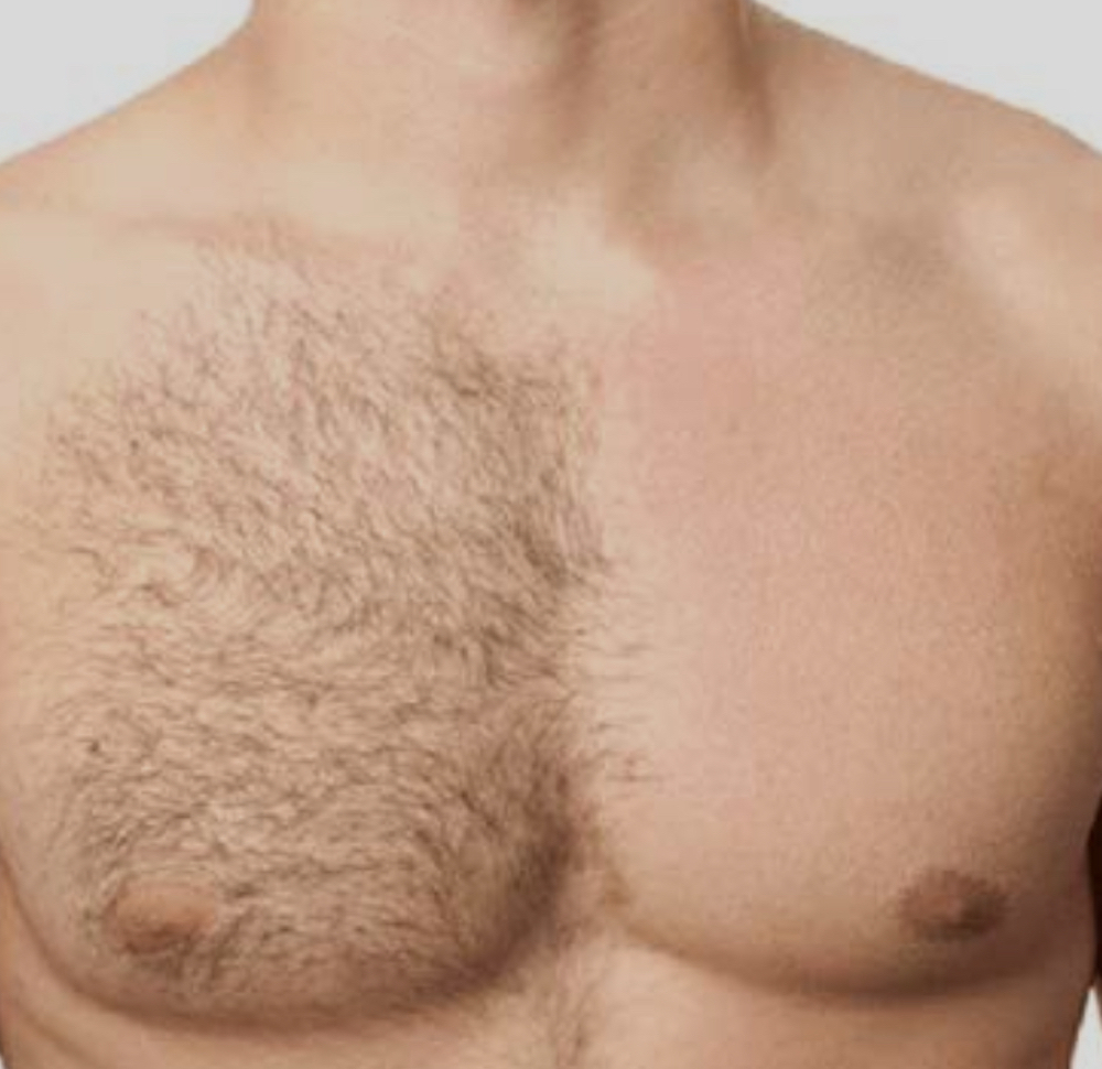 Chest Wax