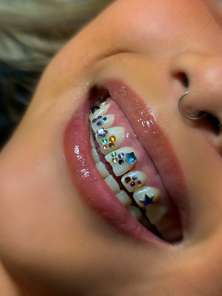 Tooth Gems