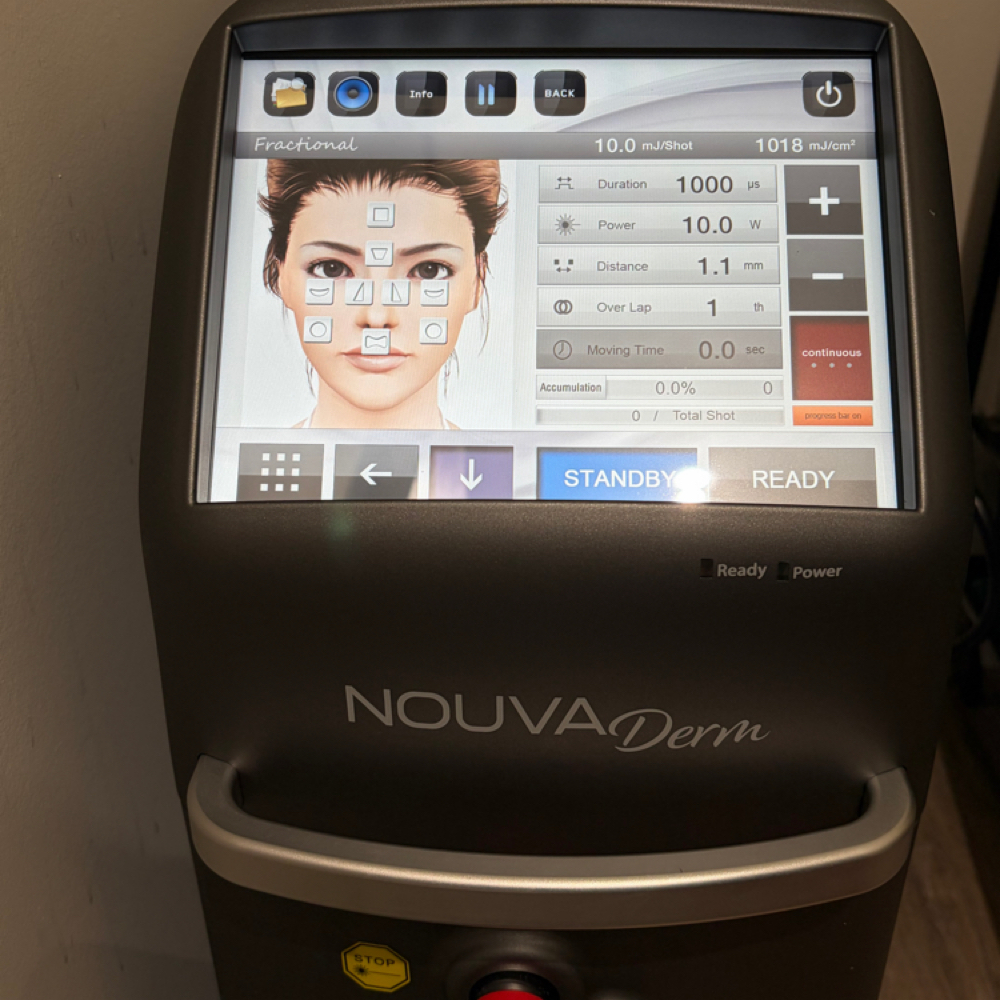 NouvaDerm Laser Treatment at Modern Beauty Wellness And Aesthetics in Milford, CT