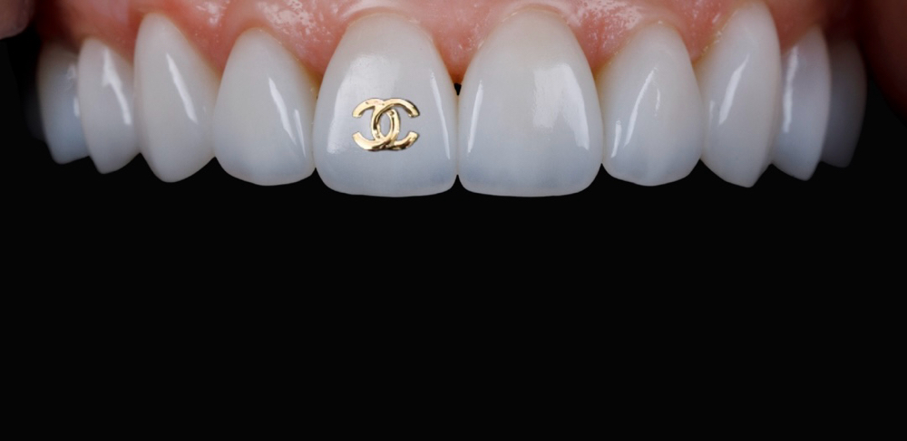 18k Gold Designer Charm