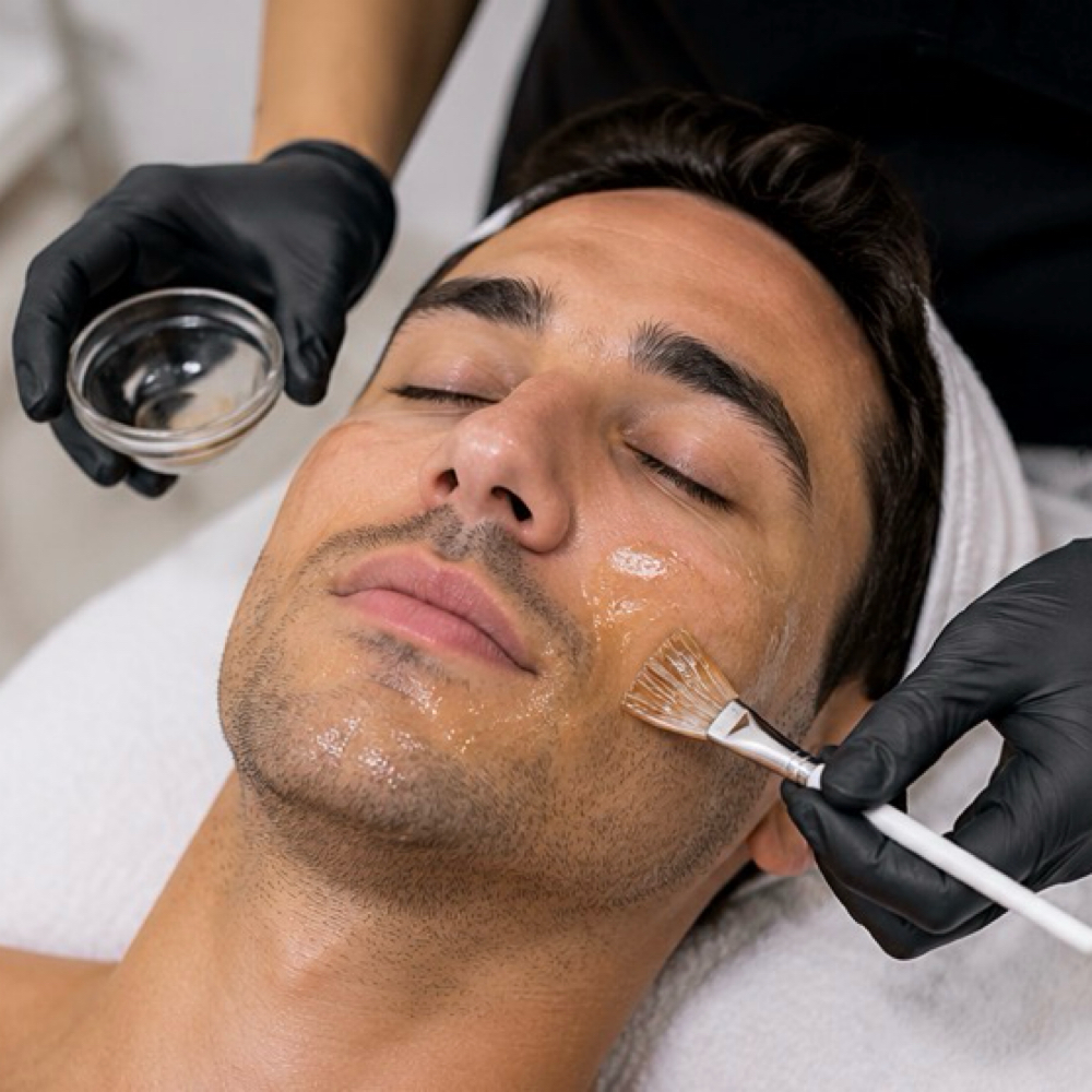VI Peel Purify with Precision + Pep at OnlyBeauty Aesthetics in Brighton, CO