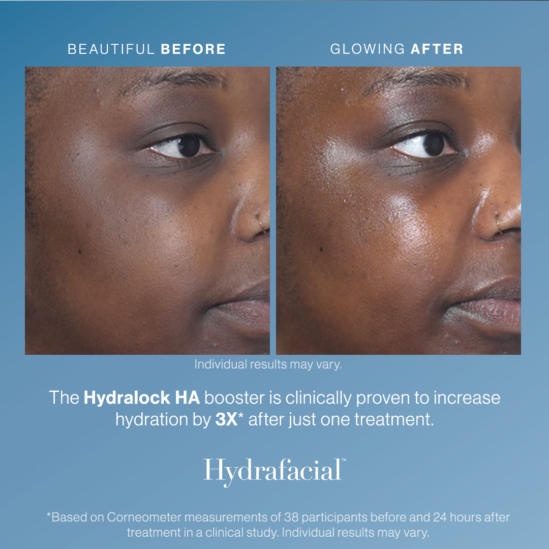 Hydrafacial The Deluxe