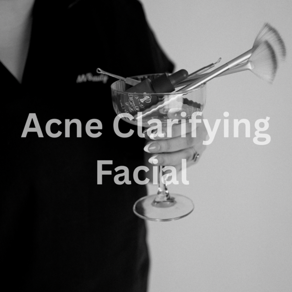 Acne Clarifying Facial at MV Beauty in Broken Arrow, OK