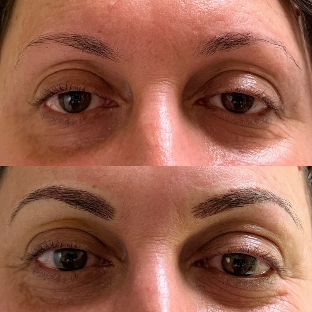 Microblading