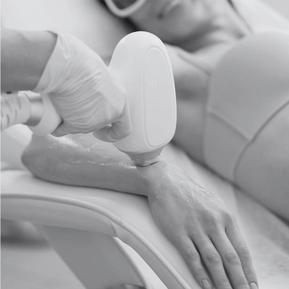 Laser Hair Removal - Arms at Kietre Wellness & Aesthetics in North Las Vegas, NV