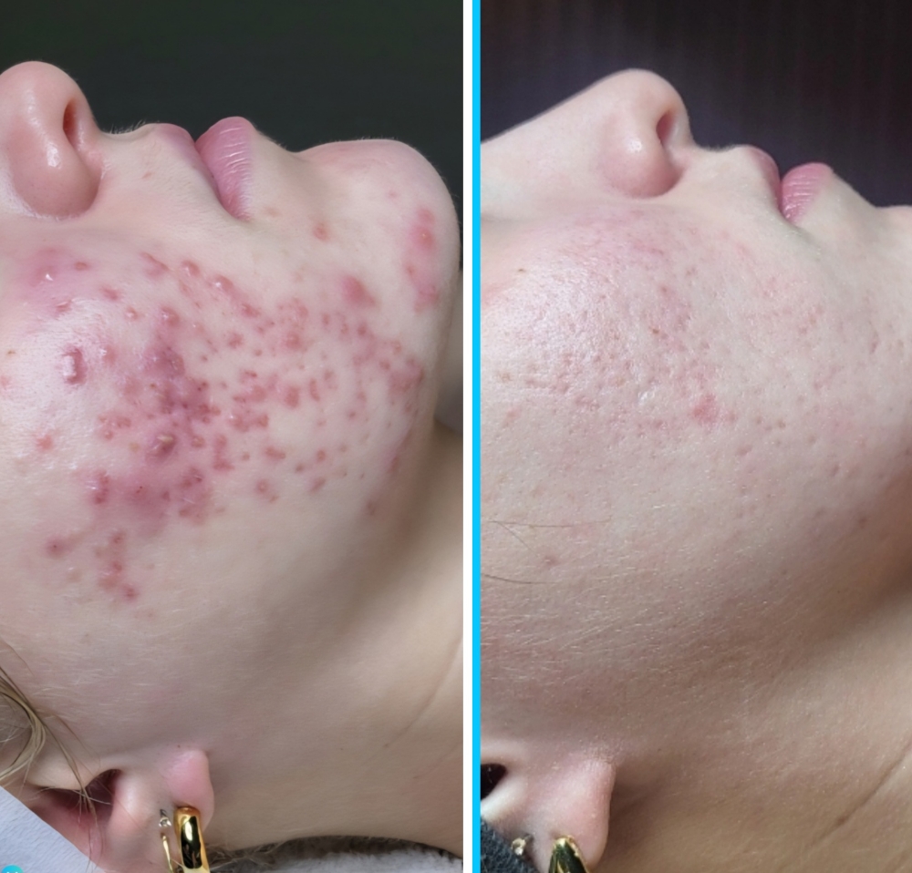 Restore and Rescue Retreat Plan