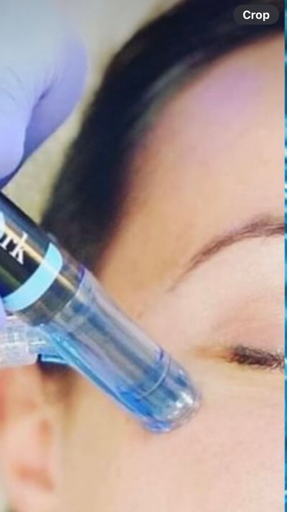 Hydrafacial Eye Perk (add On)