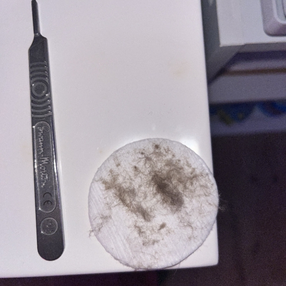 The Smooth Stem Dermaplaning Facial at The Beauty Garden in Bremerton, WA
