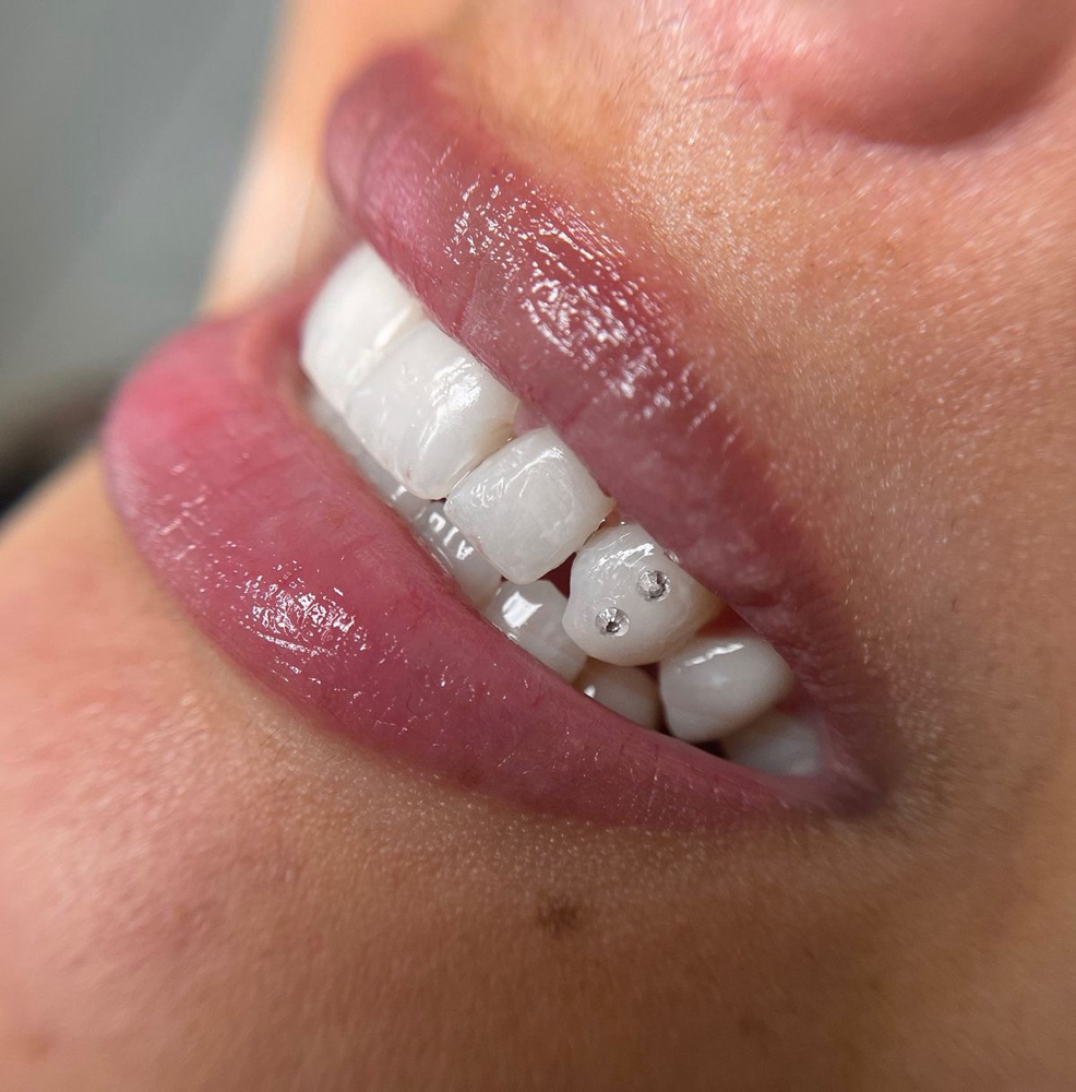 Teeth Whitining at Beauty With Jazz in Tooele, UT