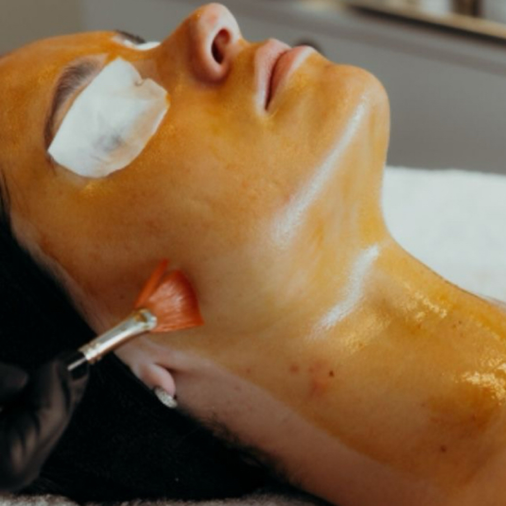 Corrective Peel / Vitamin A at ComplexionbyCali in South Jordan, UT