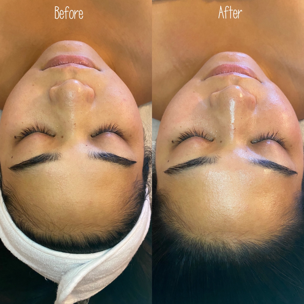 Customized Facial
