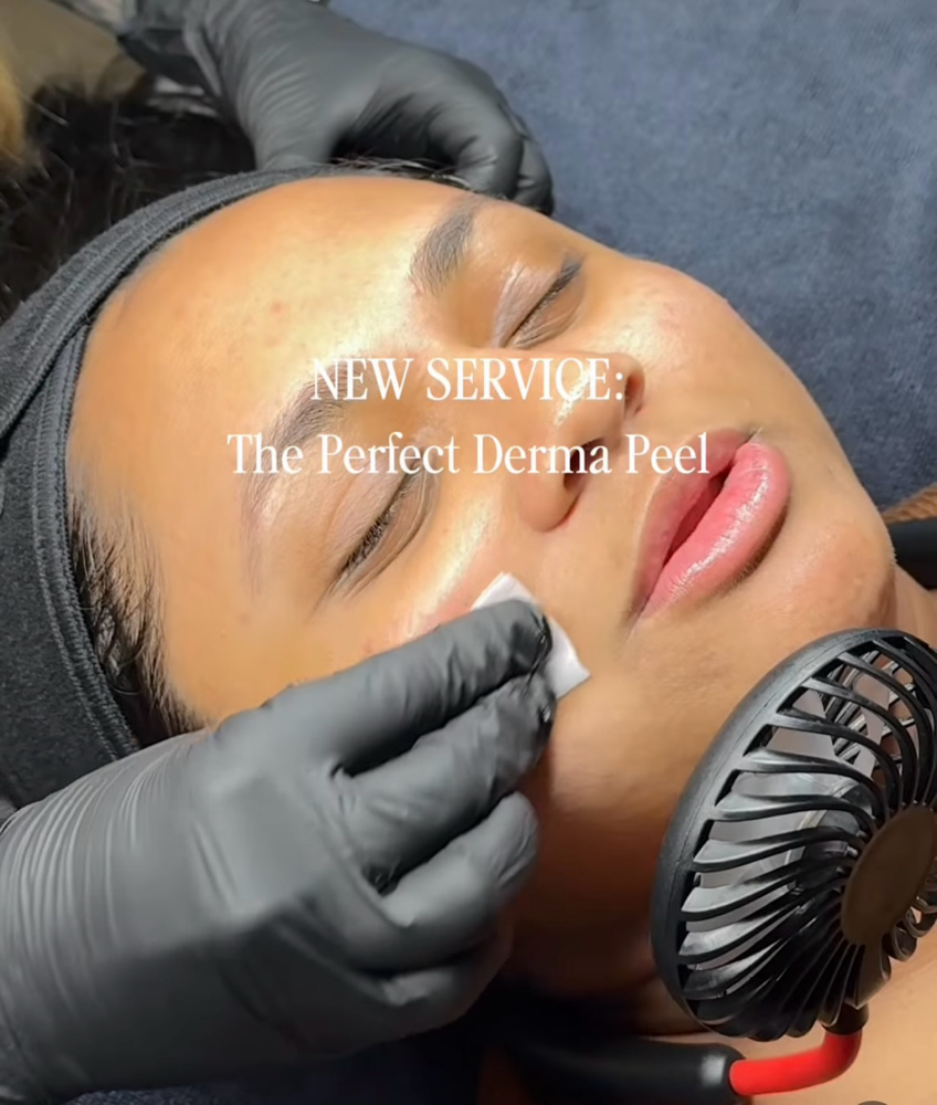 Perfect Derma Peel