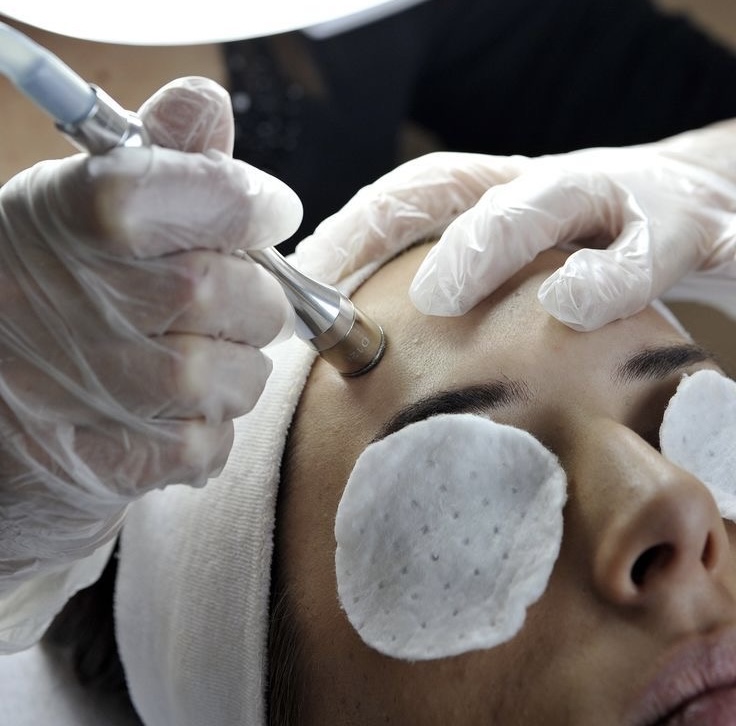 MICRODERMABRASION FACIAL