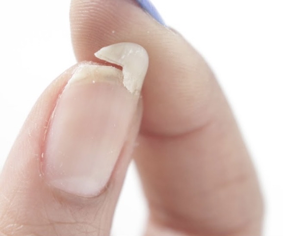 Nail Repair