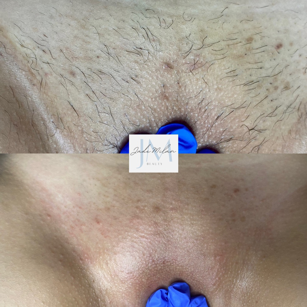 Brazilian Wax