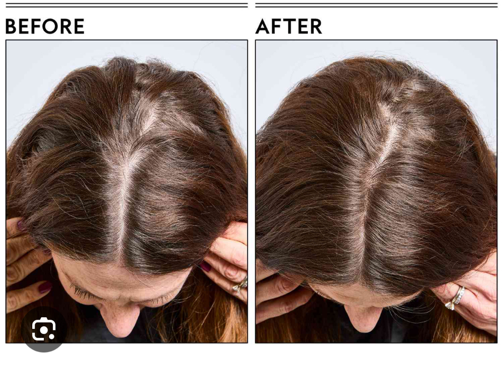Root touch up