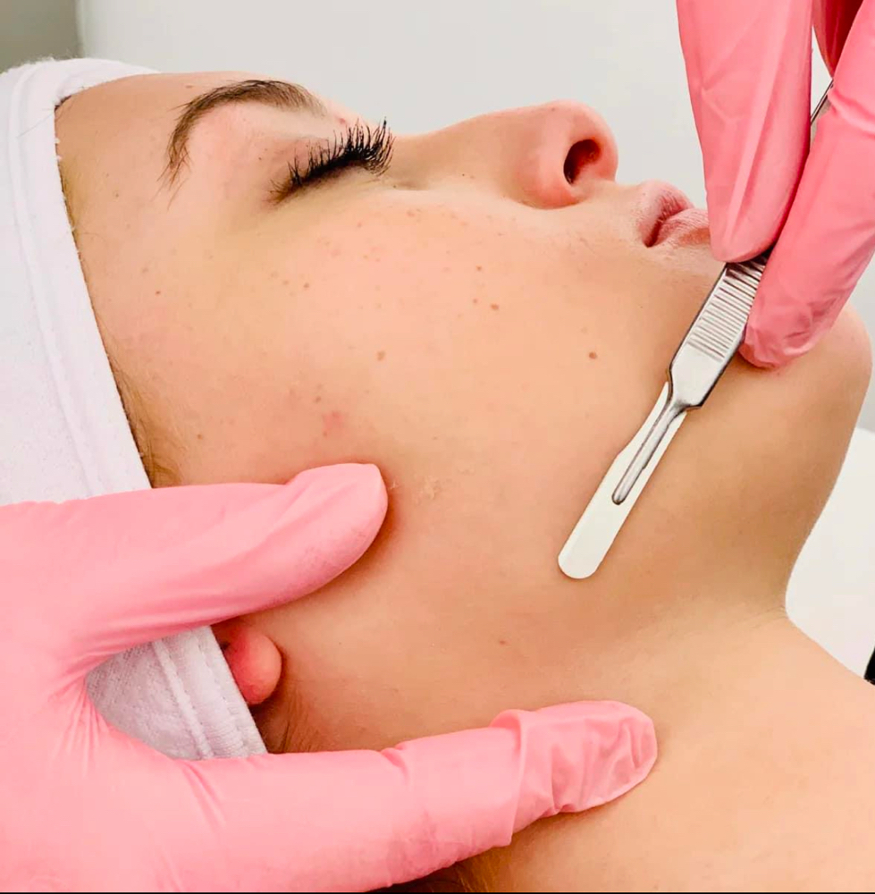 Dermaplane