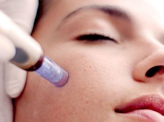 Microneedling w/ Procell MD 3 Pack