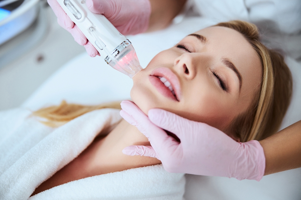 Fractional Microneedling RF