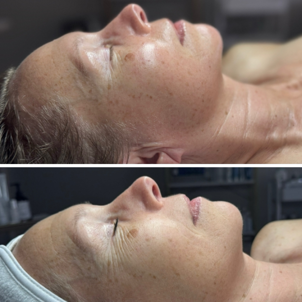 Firming Facial (Aging Skin)