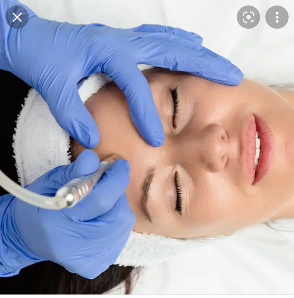 Microdermabrasion Facial