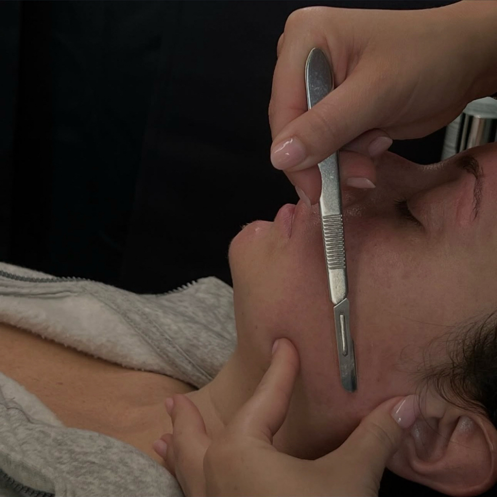 Add-On Dermaplane at Bloom Beauty in Waynesboro, TN