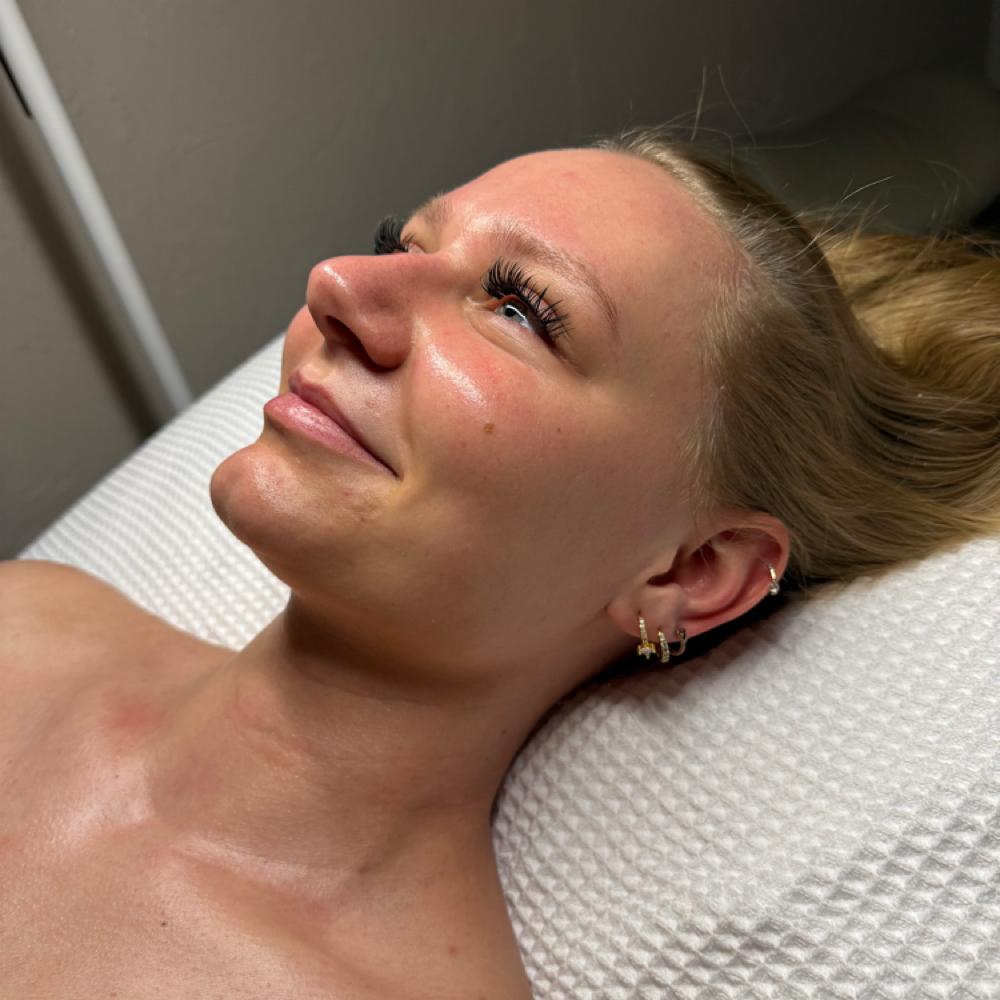Halo Express Dermaplane at Halo Aesthetics in PLYMOUTH, WI