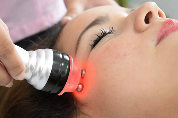 Radiofrecuncia Facial
