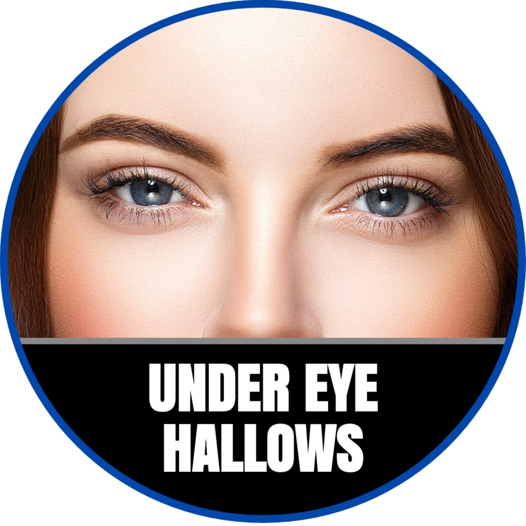 "Eyelight" Under Eye Derma Filler at Vibe Medispa & Skincare in Lakewood, CO