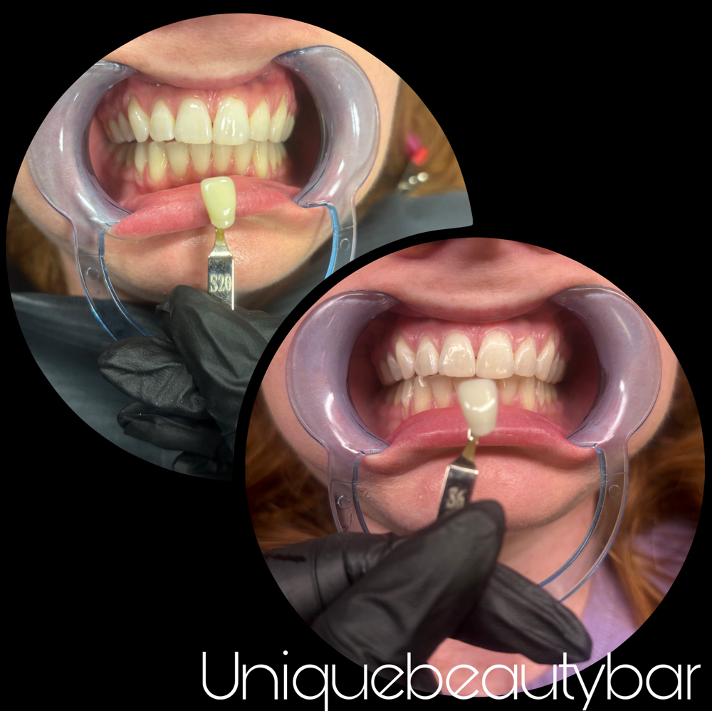Pro Max Gel