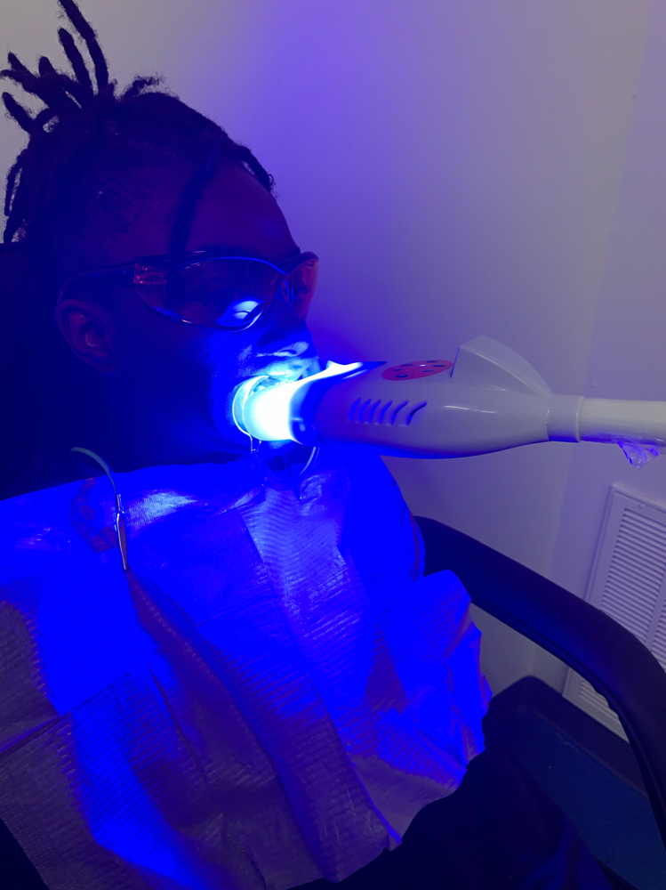 Teeth Whitening