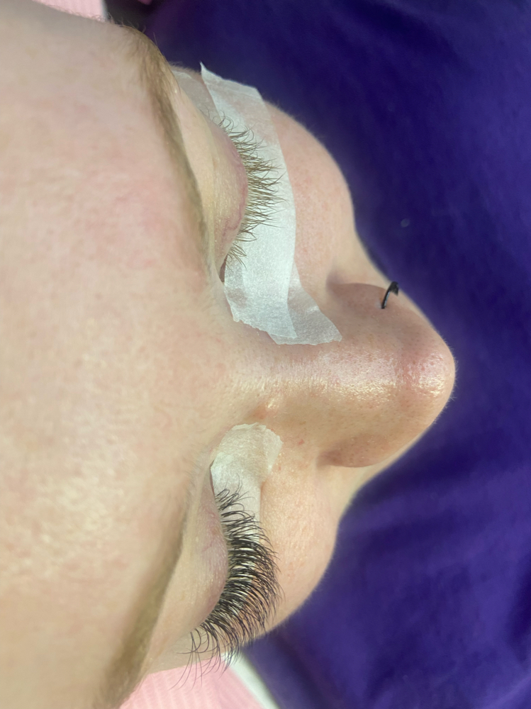 Lash Removal