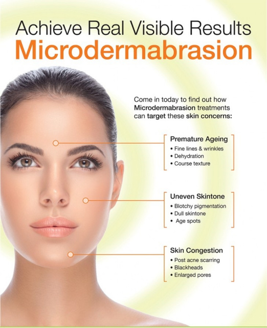 Microdermabrasion