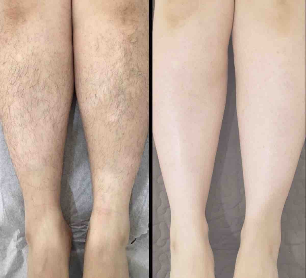 Leg Wax (Full)