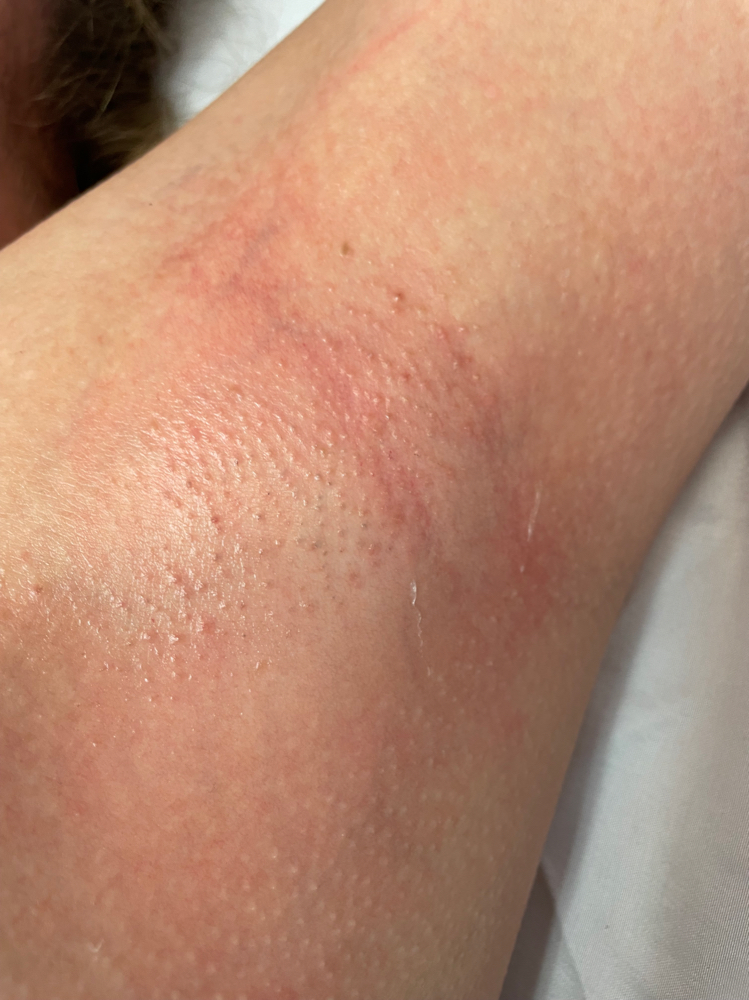 Underarm Wax