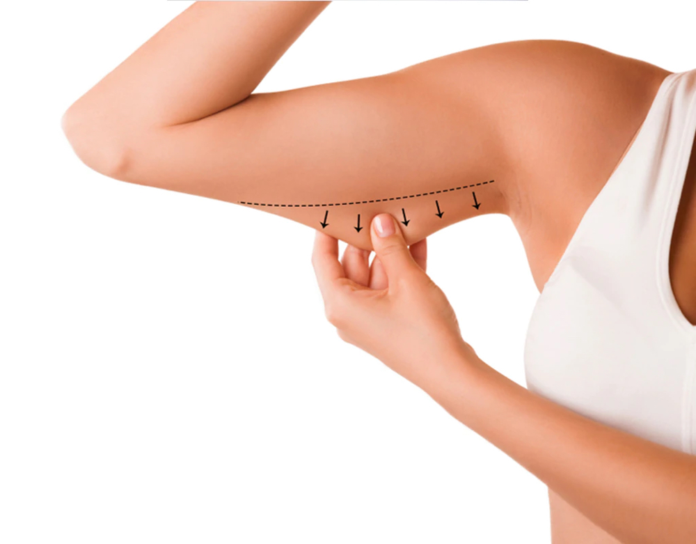 3 Session Arms